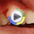 Ortodonti Video 5